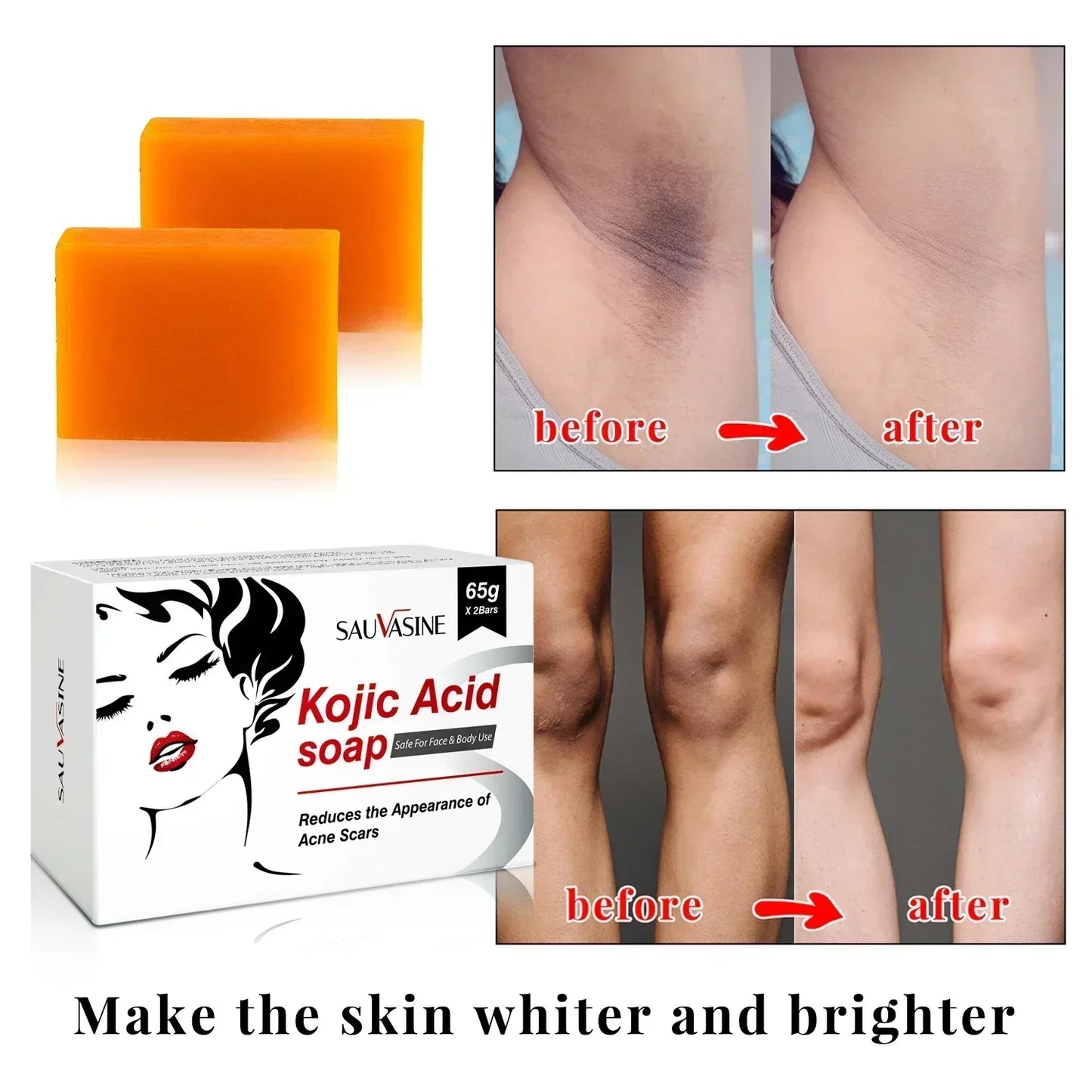 Kojic Acid Skin Care Set